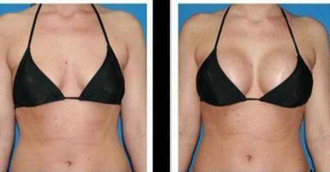 Crème Raffermissante de seins