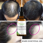 l'Huile Essentielle Anti-Chute et Croissance  des Cheveux