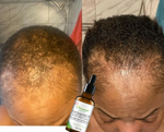 l'Huile Essentielle Anti-Chute et Croissance  des Cheveux