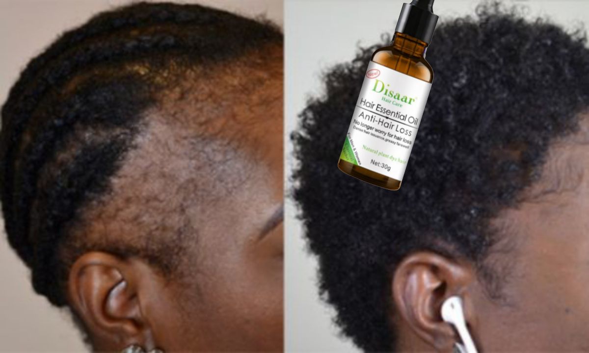 l'Huile Essentielle Anti-Chute et Croissance  des Cheveux