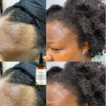 l'Huile Essentielle Anti-Chute et Croissance  des Cheveux